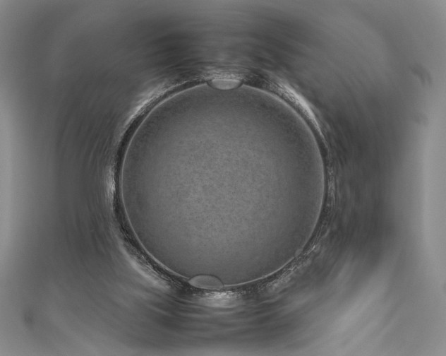 X0000111190059200907011420