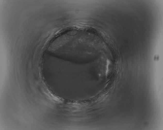 X0000111191009200907151344