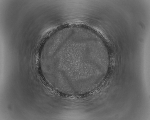 X0000111191063200907221104