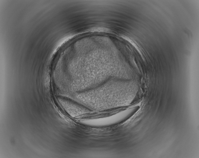 X0000111191115200907221103