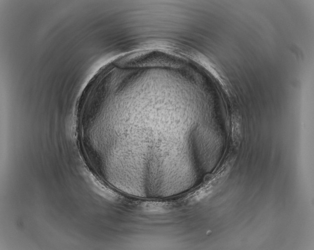 X0000111191116200907221103