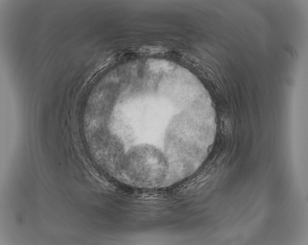 X0000111191393200907221059