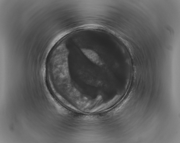 X0000111191418200907221100