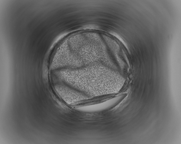 X0000111191115200907291158