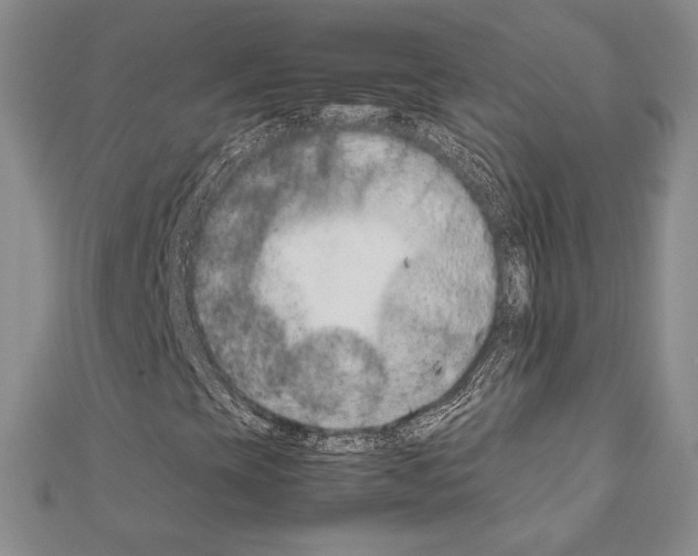 X0000111191393200908121037