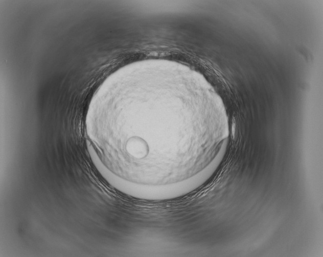 X0000111191444200908121037