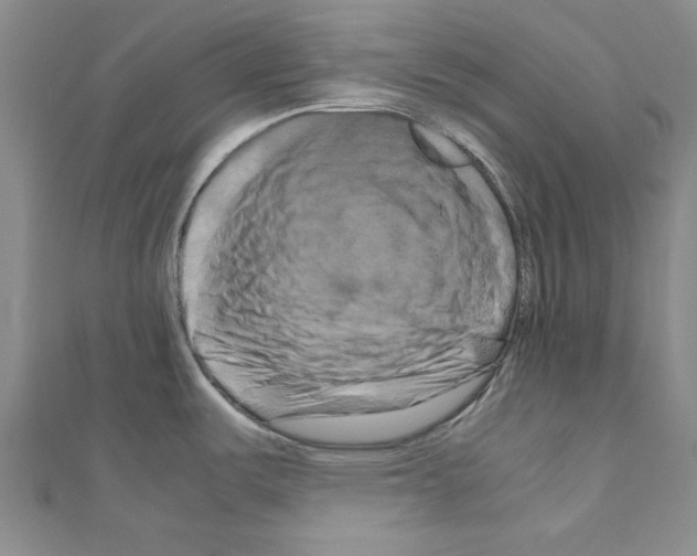 X0000111191487200908121036