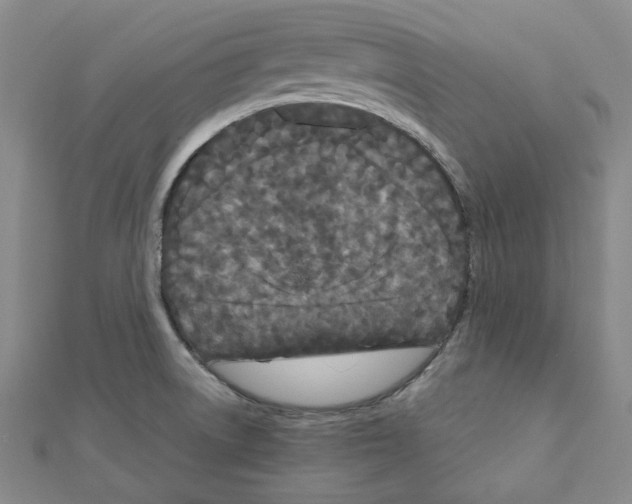 X0000111191522200908121036