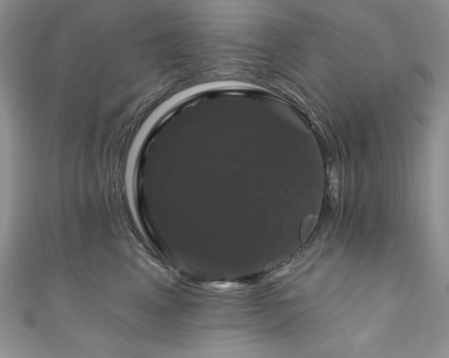 X0000111200617200907011434