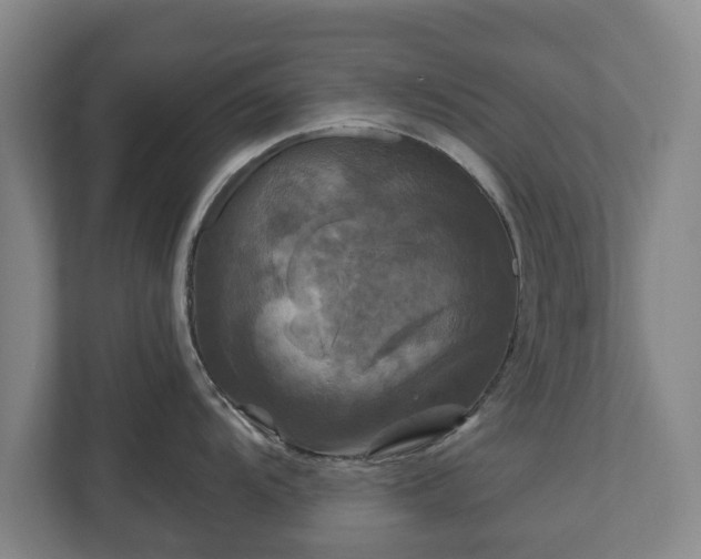 X0000111201104200907081237