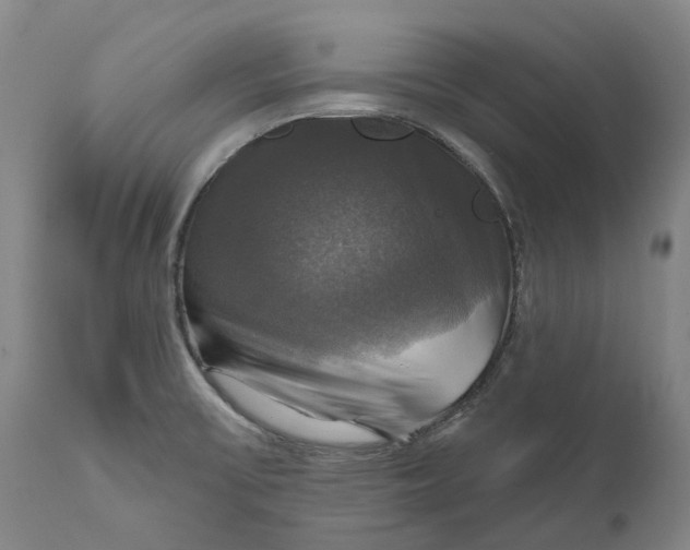 X0000111201475200907151401