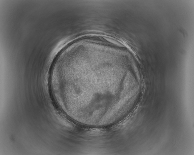 X0000111200151200907221137