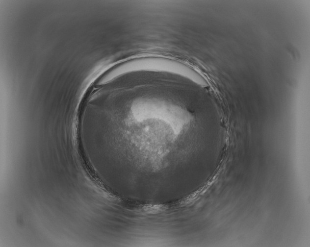 X0000111200152200907221137