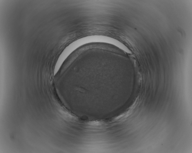 X0000111200237200907221136