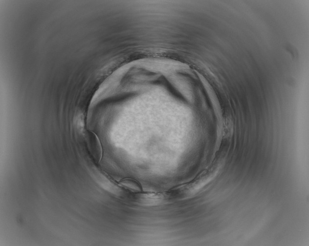 X0000111200238200907221136