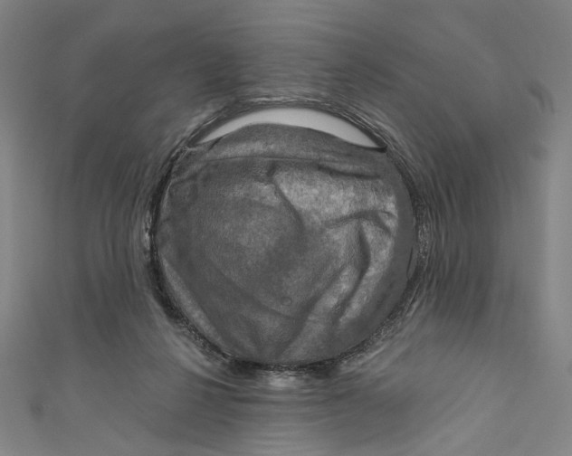 X0000111200264200907221136