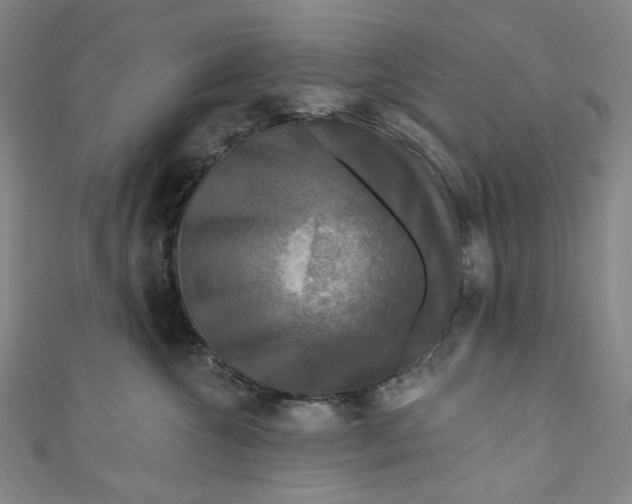 X0000111200572200907221132