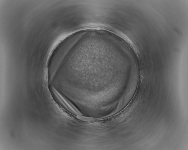 X0000111201472200907221120