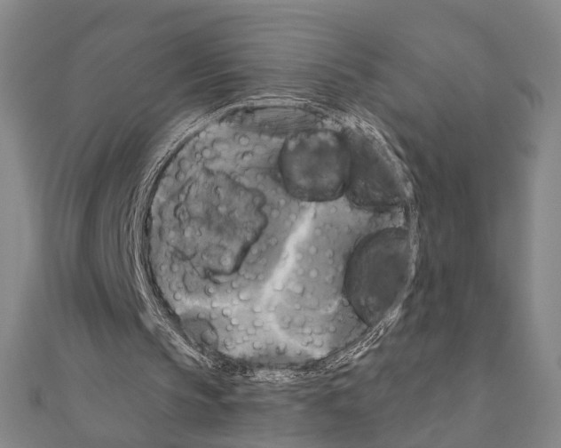 X0000111200145200908121118