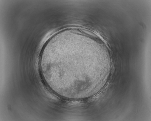 X0000111200151200908121118