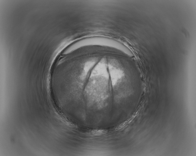 X0000111200152200908121118