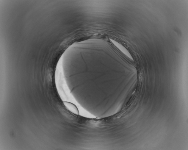 X0000111200570200908121113