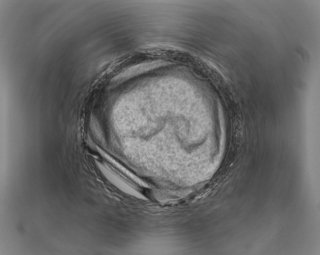 X0000111200965200908121106