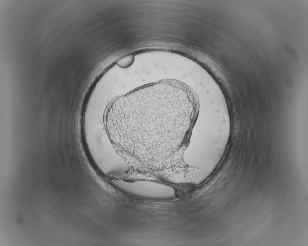 X0000111201237200908121103