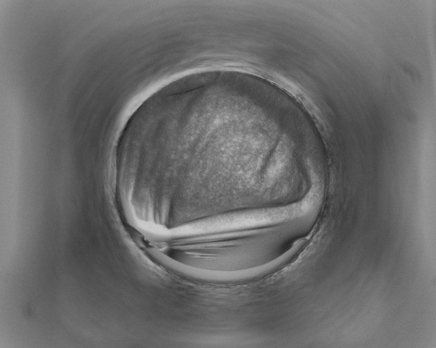 X0000111201520200908121058