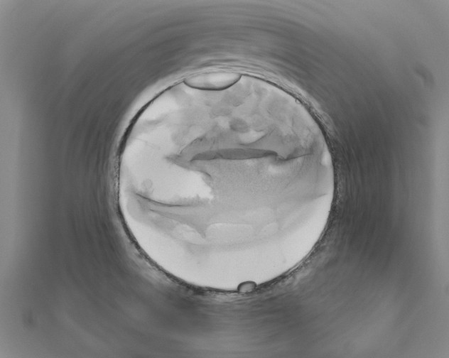 X0000111201522200908121058