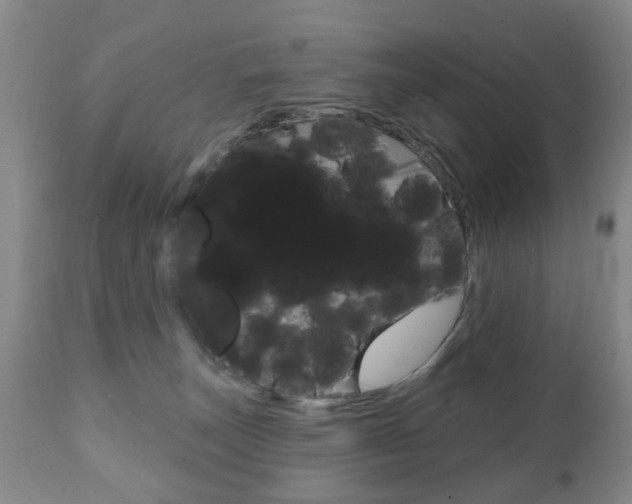 X0000111220179200907021009
