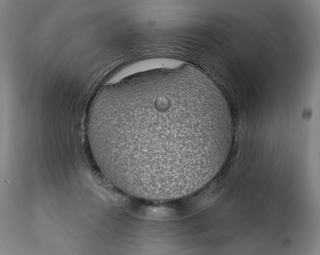 X0000111220360200907161257