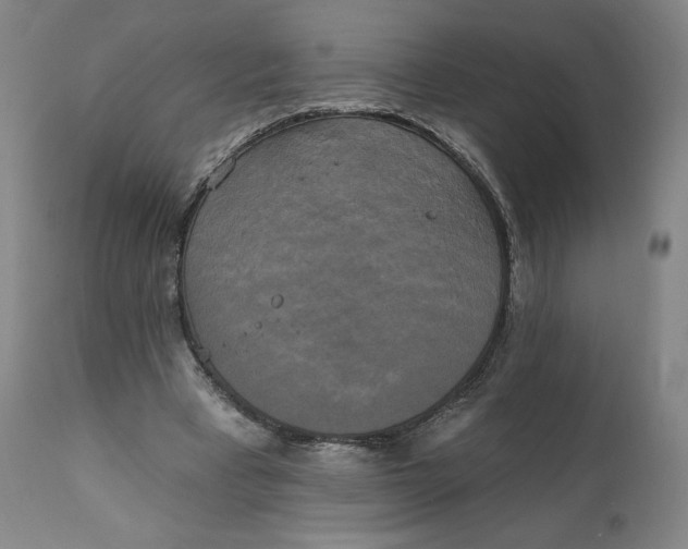 X0000111220393200907161257