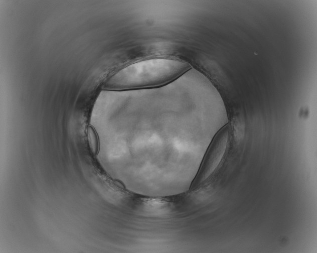 X0000111220380200907231446