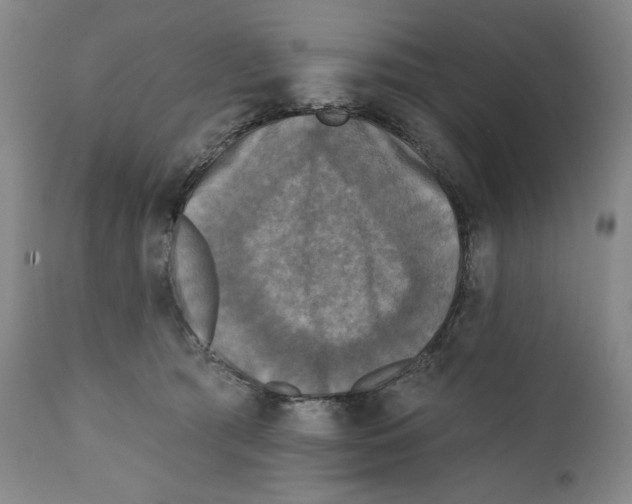 X0000111220417200907231445
