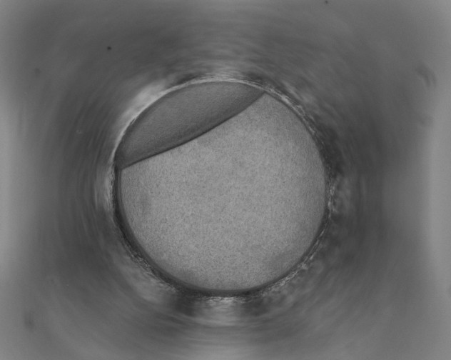 X0000111220152200907301233