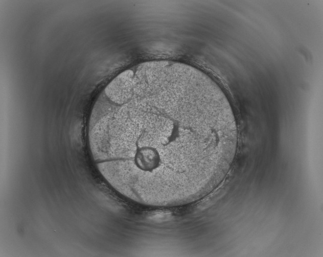 X0000111220162200907301233