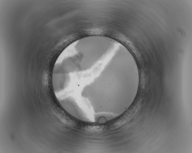 X0000111220161200908131109