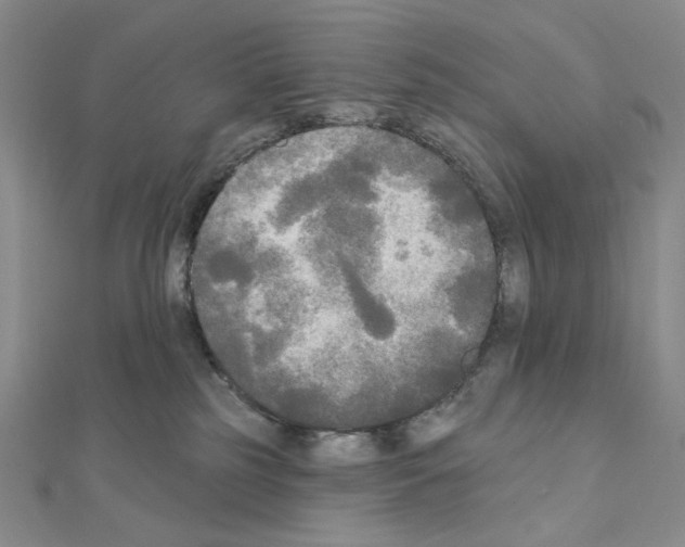 X0000111220185200908131109