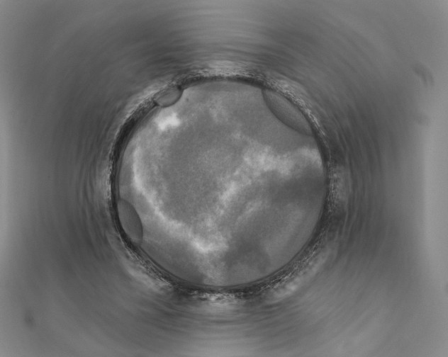 X0000111220395200908131106