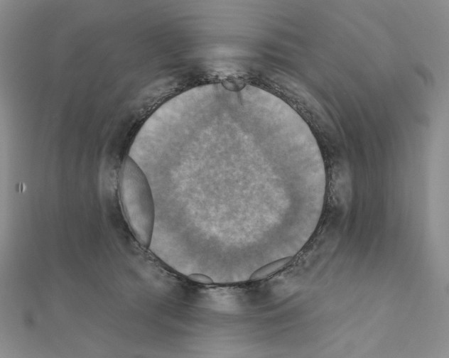 X0000111220417200908131106