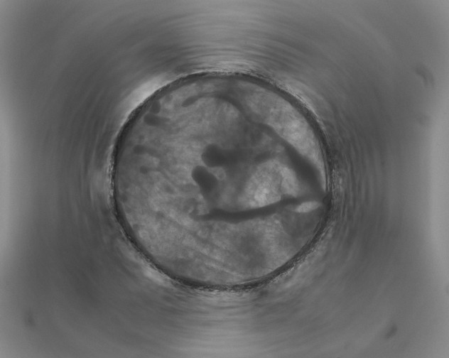 X0000111231071200908131118