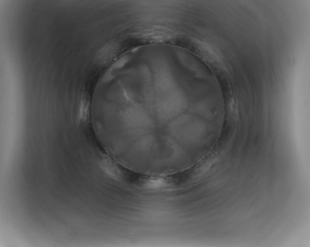 X0000111240177200907021418