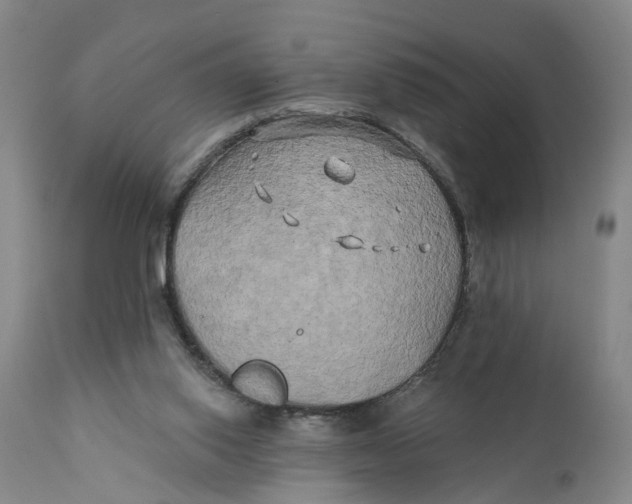 X0000111240062200907231539