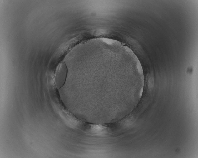 X0000111240380200907231534