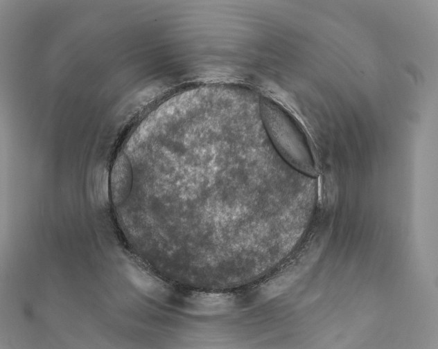 X0000111240205200908131153