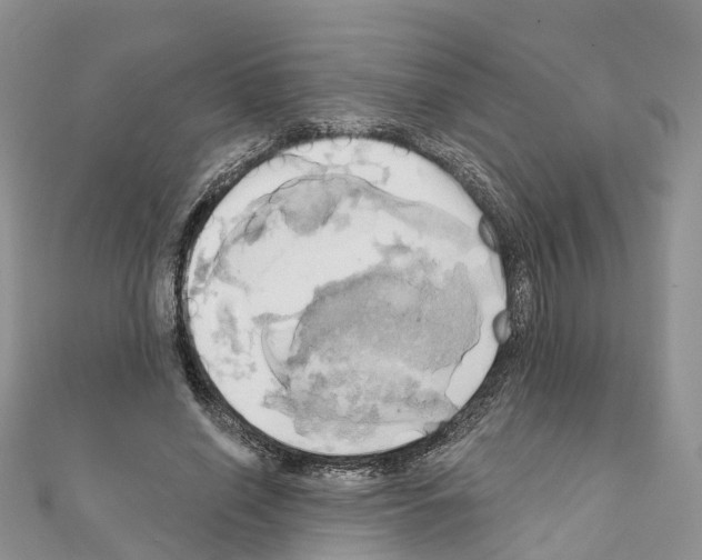 X0000111240638200908131145