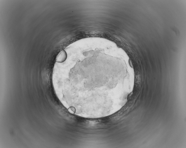 X0000111240662200908131146