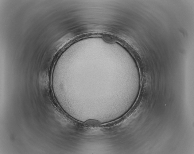 X0000111240969200908131141