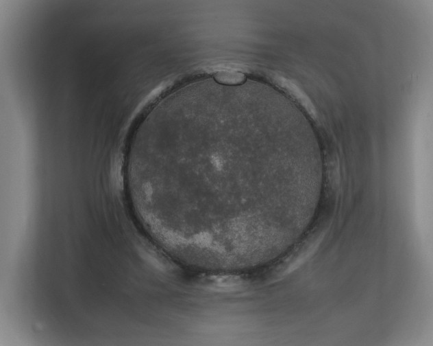X0000111250395200907021435